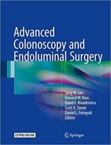 Advanced Colonoscopy and Endoluminal Surgery by Sang W. Lee, ISBN-13: 978-3319483689